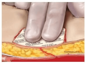 OneStop Vascular Technology